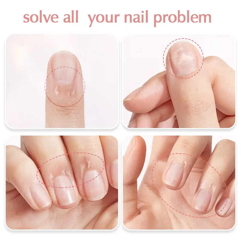 cuticle-oil-nail-problems.webp
